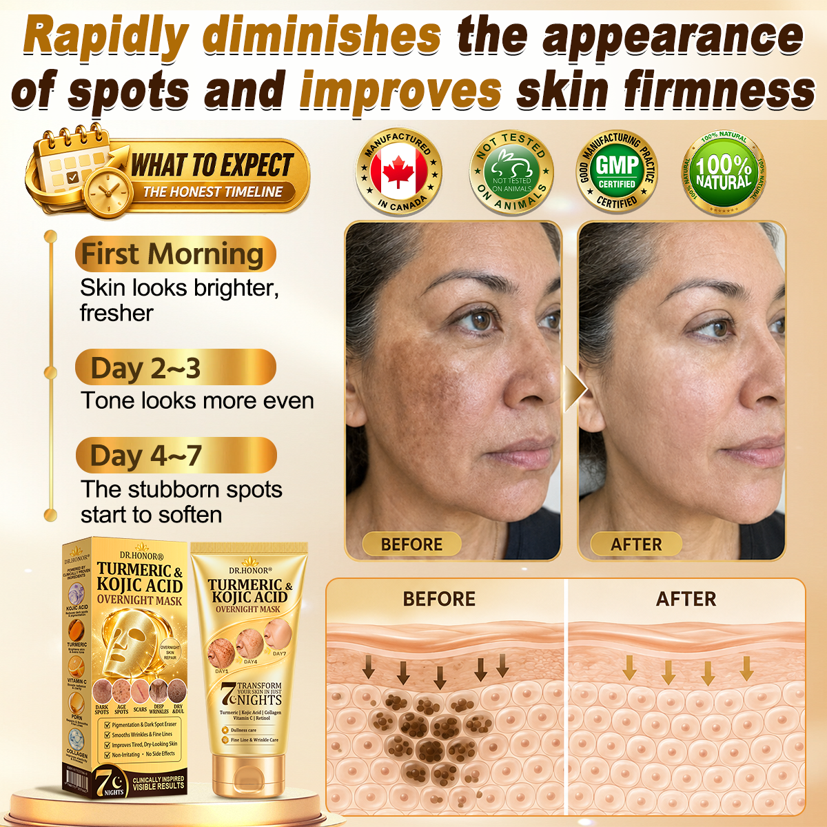 𝐇𝐢𝐬𝐤𝐢𝐧® 50%