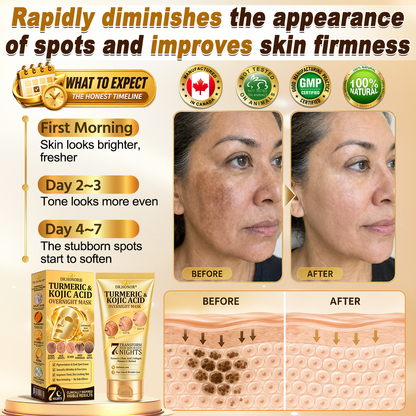 𝐇𝐢𝐬𝐤𝐢𝐧® 50%