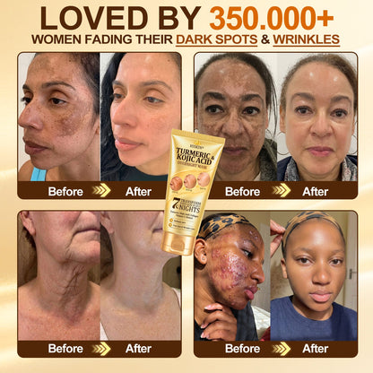 𝐇𝐢𝐬𝐤𝐢𝐧® 50%